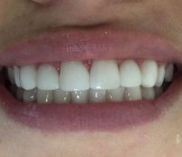 IMG-20161215-WA0007