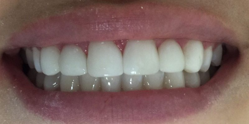 IMG-20161215-WA0007