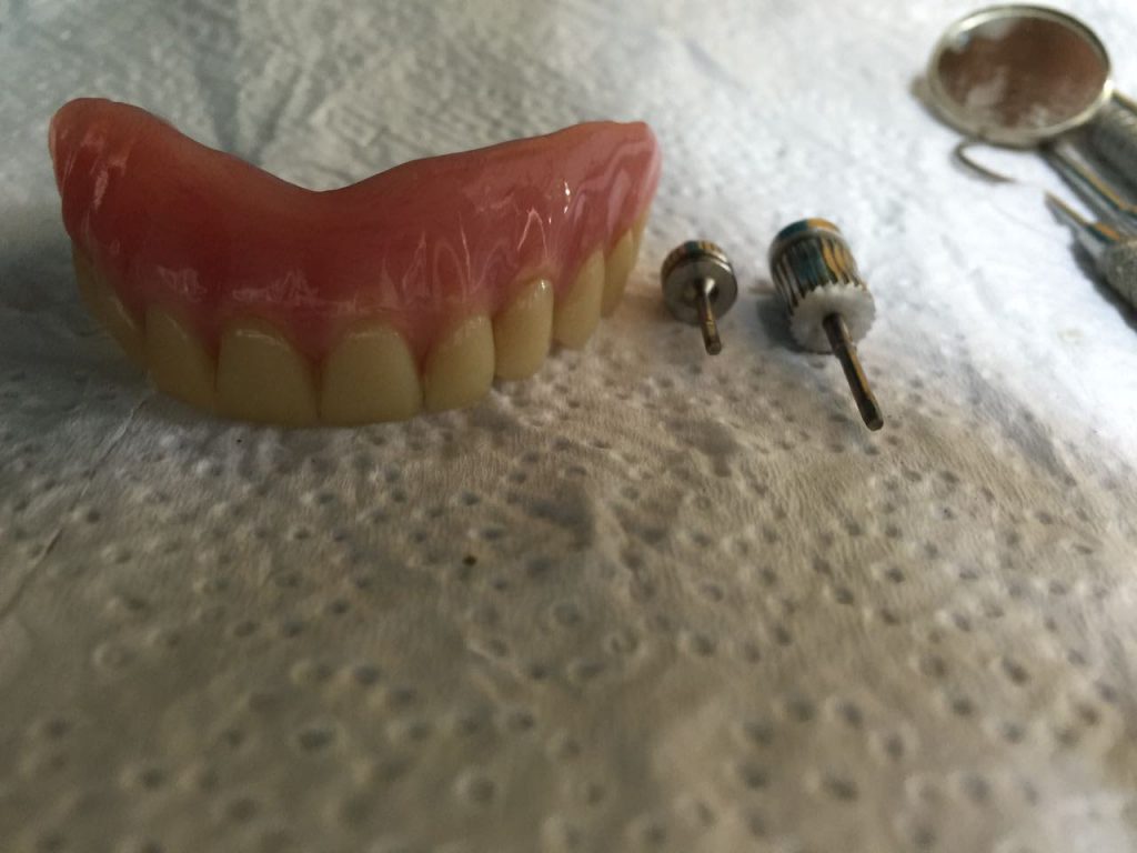 Tratamientos especializados en rehabilitación oral, cirugía dental y Odontologia general para toda la familia